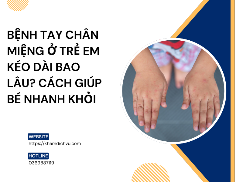 Bệnh tay chân miệng ở trẻ em kéo dài bao lâu? Cách giúp bé nhanh khỏi