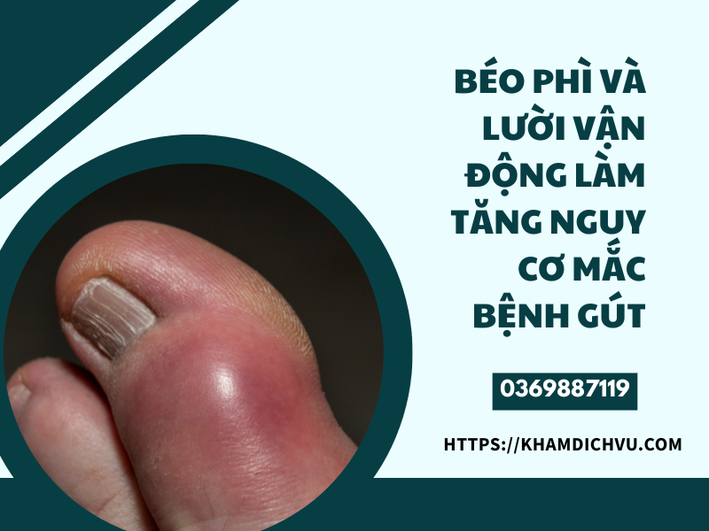 Bệnh gút có liên hệ gì với thói quen sinh hoạt hàng ngày?